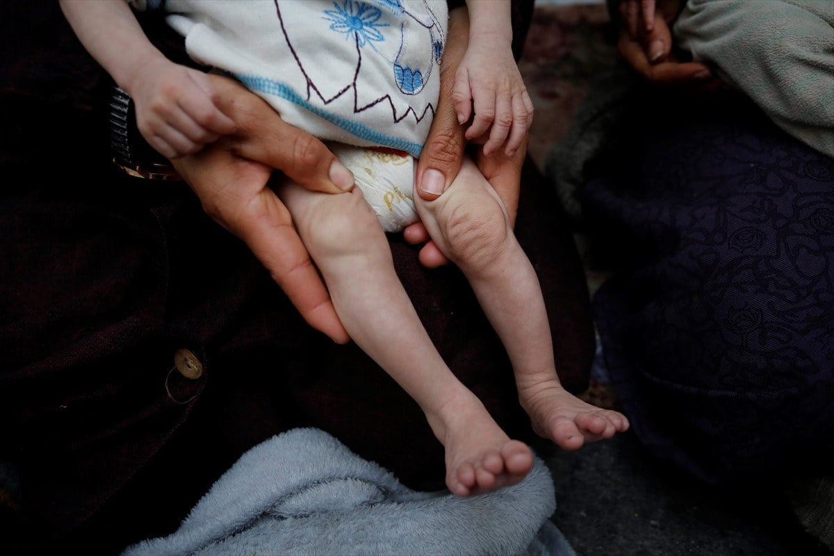 1711524803 465 Filistinli ucuz bebekler olum tehlikesi altinda