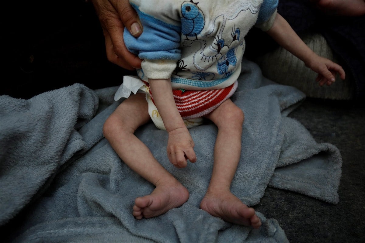 1711524803 841 Filistinli ucuz bebekler olum tehlikesi altinda