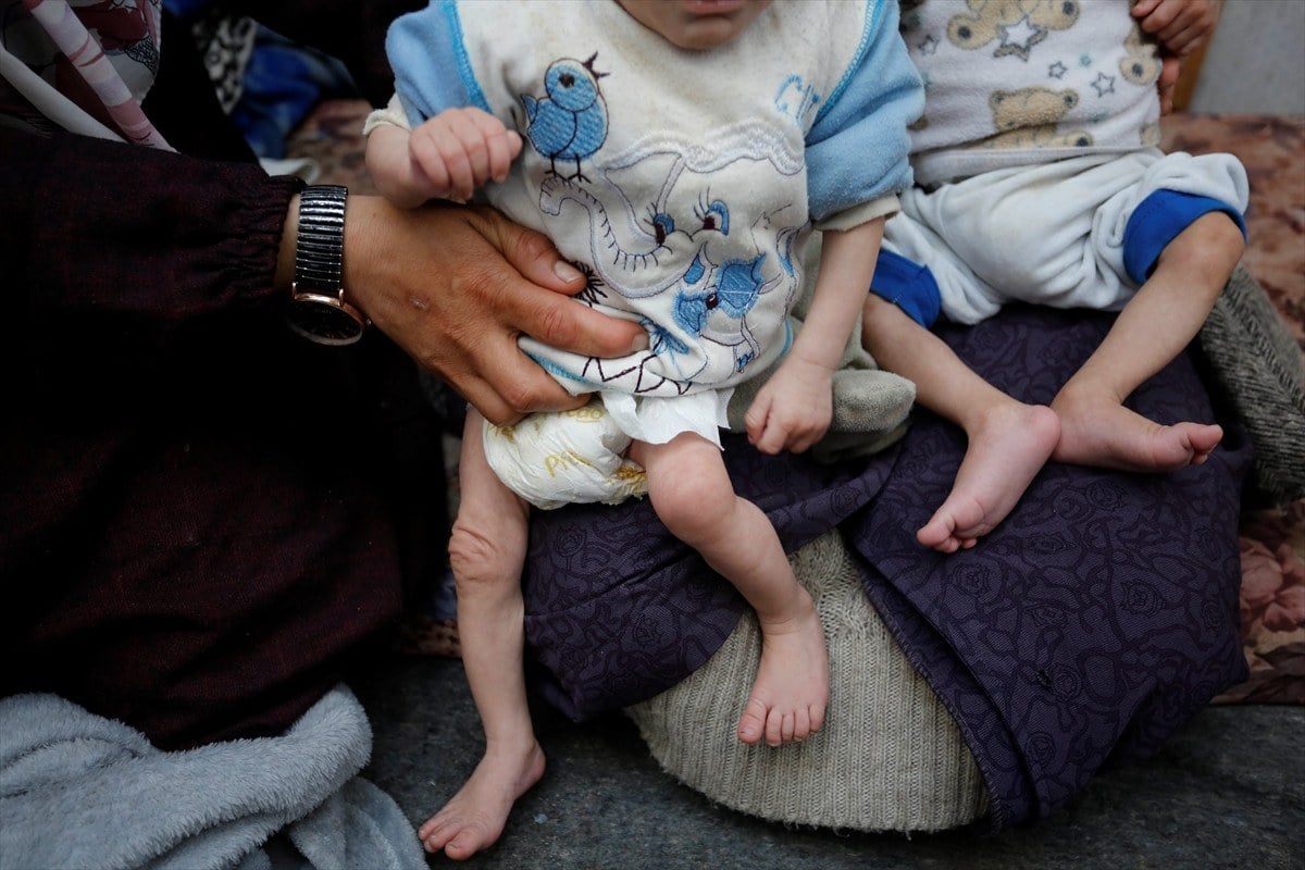 1711524803 980 Filistinli ucuz bebekler olum tehlikesi altinda